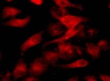 TraKine™ Cell Plasma Membrane Staining Kit (Orange Fluorescence)
