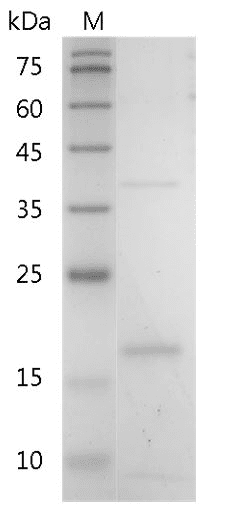 Mouse IL-19 Protein, His tag (Animal-Free)