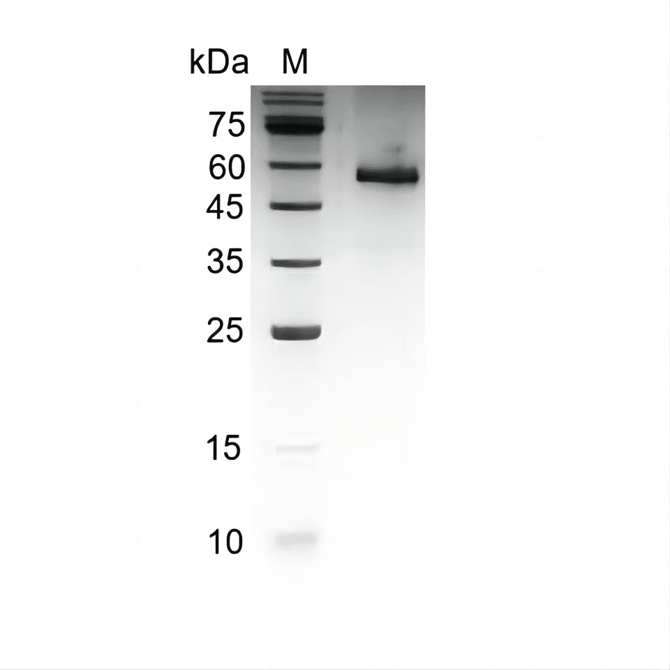 Human Noggin protein, His tag (Animal-Free)