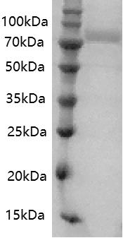 Human Transferrin protein