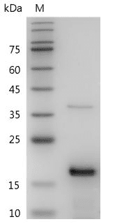 Mouse/Rat FGF-2 protein, His tag (Animal-Free)