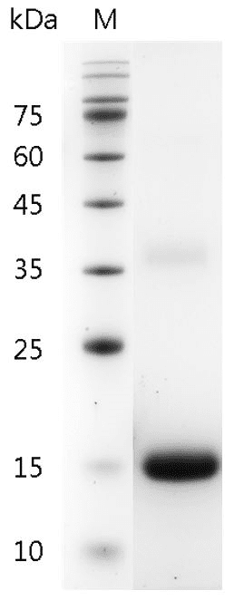 Human IL-31 Protein, His tag (Animal-Free)