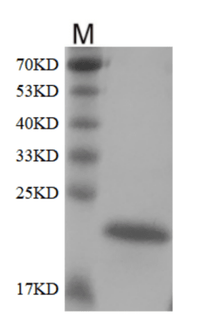 Human FGF-21 protein