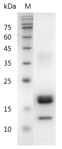 Human M-CSF Protein, His tag (Animal-Free)