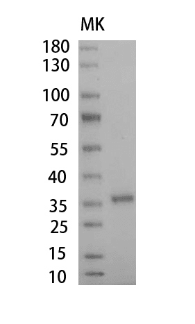 Human Haptoglobin Protein, His tag