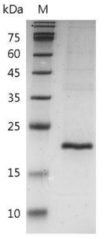 Mouse TNF beta Protein, His tag (Animal-Free)