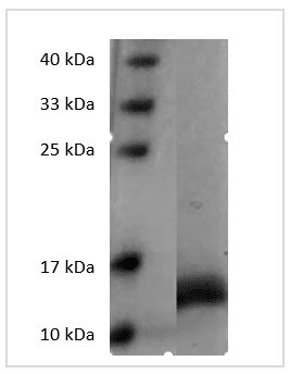Human GM-CSF protein