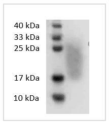 Human GM-CSF protein , His tag (Animal-Free)