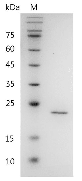 Human FGF-3 Protein, His tag (Animal-Free)