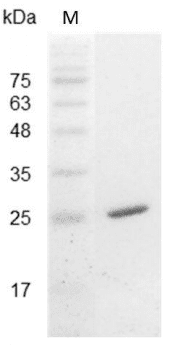 Mouse IL-30 Protein, His tag (Animal-Free)