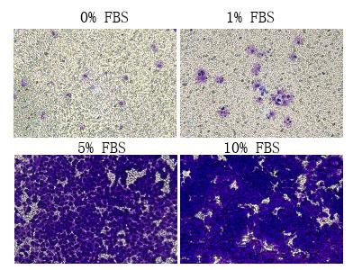 Cell Invasion Assay Kit (24 well,8μM)