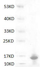 Human S100A9 Protein