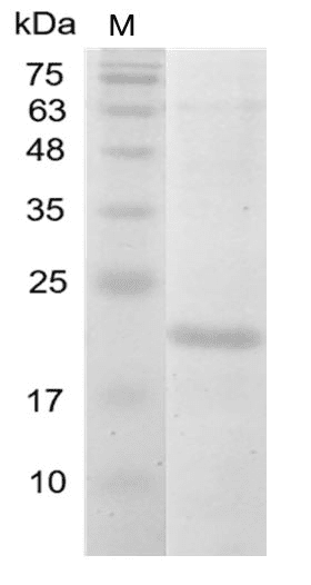 Human IL-38 Protein, His tag (Animal-Free)