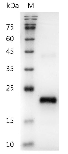 Human VEGF165 protein, His tag (Animal-Free)