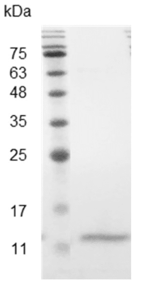 Mouse CCL4 Protein, His tag (Animal-Free)