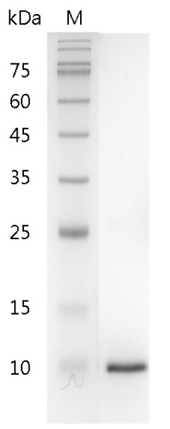 Mouse β-NGF protein, His tag (Animal-Free)