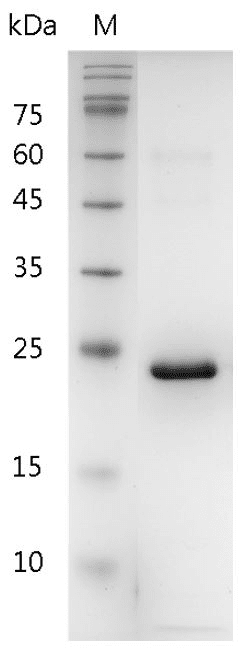 Human FGF-19 Protein, His tag (Animal-Free)