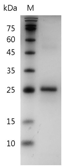 Mouse IL-34 Protein, His tag (Animal-Free)