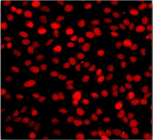 One-step TUNEL Apoptosis Assay Kit (Red Fluorescence)