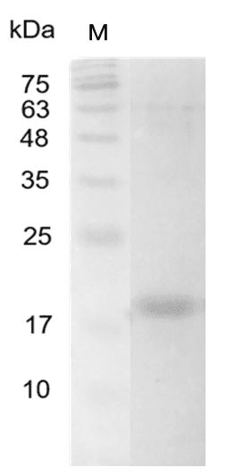 Human IL-16 Protein, His tag (Animal-Free)