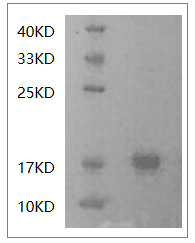 Human IFN-γ protein