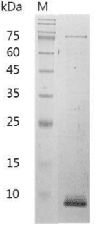 Mouse CXCL11 Protein, His tag (Animal-Free)