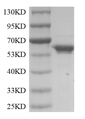 Terminal Deoxynucleotidyl Transferase (TdT)