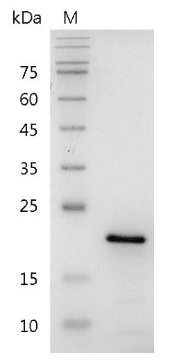Human FGF-10 Protein, His tag (Animal-Free)