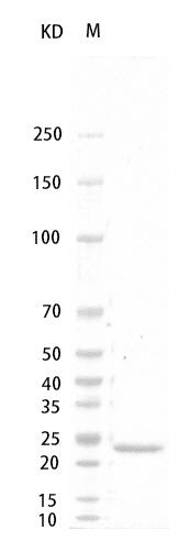 Rat  G-CSF Protein, His tag