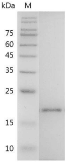 Mouse IL-38 Protein, His tag (Animal-Free)