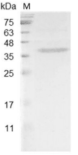 Mouse HDGF Protein, His tag (Animal-Free)