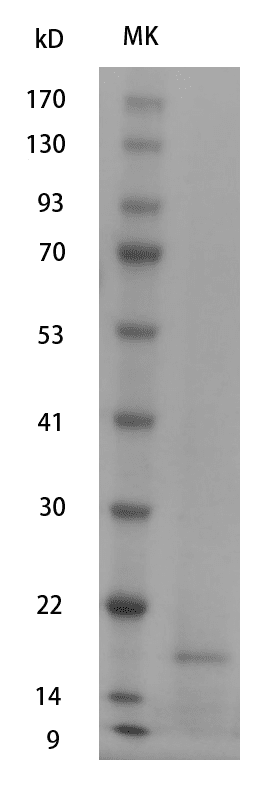 Human IL17F protein,His tag