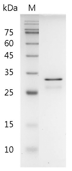 Human FGF-5 Protein, His tag (Animal-Free)