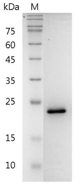 Human FGF-8a Protein, His tag (Animal-Free)