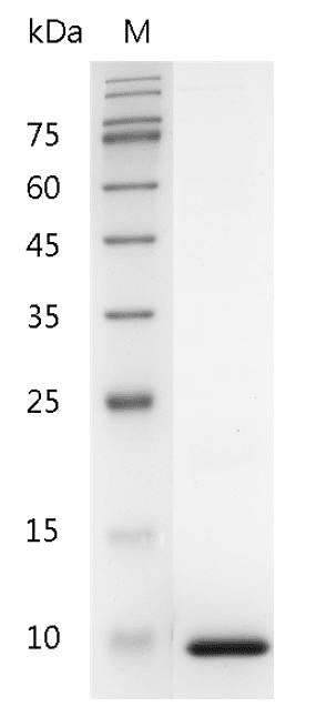 Human CXCL7 Protein, His tag (Animal-Free)