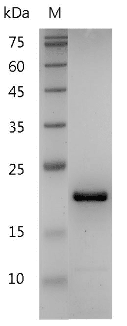 Human TNF-β Protein, His tag (Animal-Free)