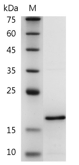 Human FGF-6 Protein, His tag (Animal-Free)
