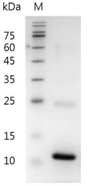 Mouse CXCL16 Protein, His tag (Animal-Free)