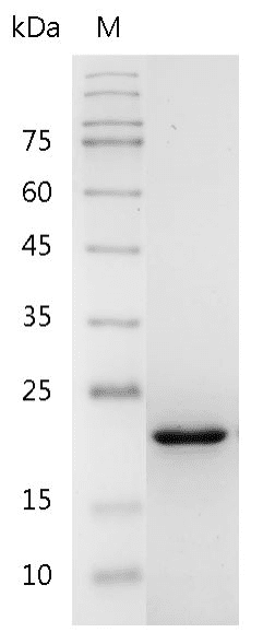 Human 4-1BBL Protein, His tag (Animal-Free)