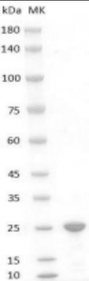 Human FGF-19 Protein, His tag
