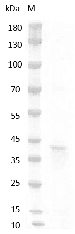 Human RSPO1/R-spondin-1 Protein