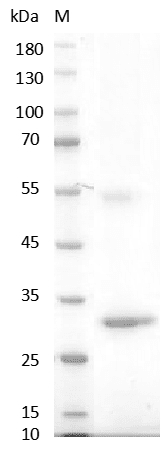 Human Noggin Protein, His tag