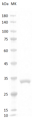 Mouse Adiponectin Protein, His tag