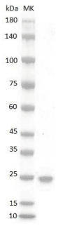 Human OSM Protein