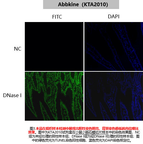 One-step TUNEL Apoptosis Assay Kit (Green Fluorescence)