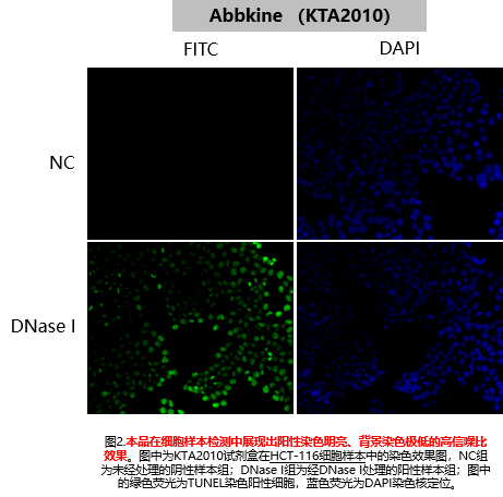 One-step TUNEL Apoptosis Assay Kit (Green Fluorescence)