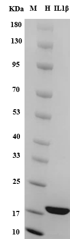 Human IL-1β protein